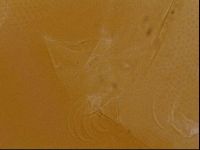 Testechiniscus laterculus image