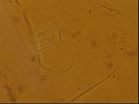Testechiniscus laterculus image