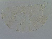 Testechiniscus laterculus image