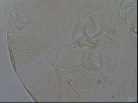Testechiniscus laterculus image