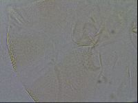 Testechiniscus laterculus image