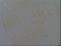 Testechiniscus laterculus image