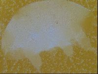 Testechiniscus laterculus image