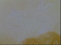 Testechiniscus laterculus image