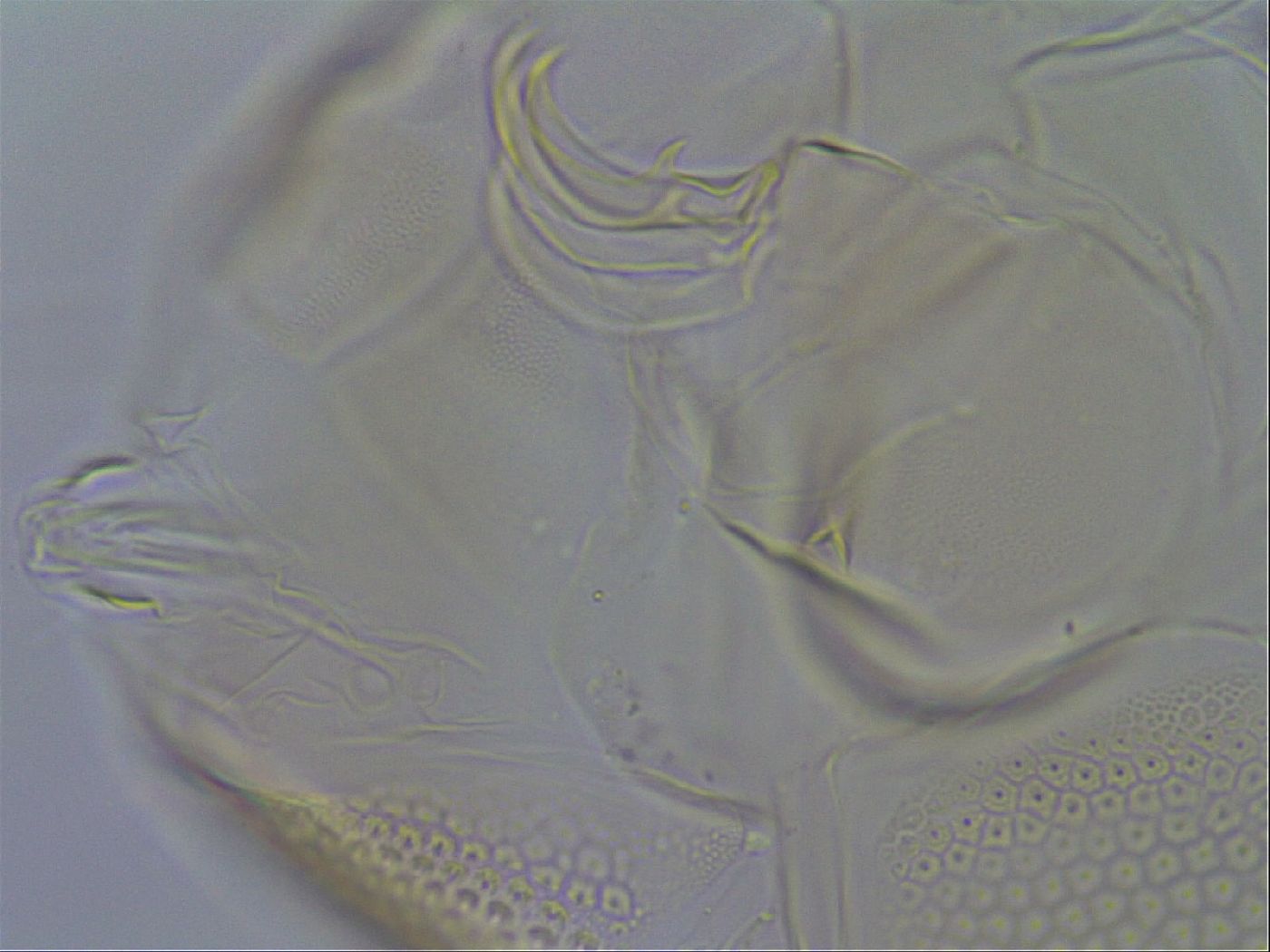 Testechiniscus laterculus image