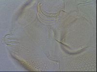 Testechiniscus laterculus image