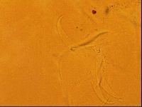 Testechiniscus laterculus image