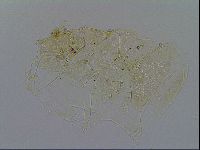 Testechiniscus laterculus image