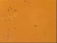 Testechiniscus laterculus image