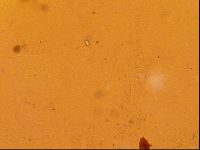 Testechiniscus laterculus image