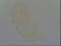 Testechiniscus laterculus image