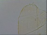 Testechiniscus laterculus image