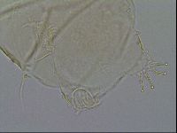 Testechiniscus laterculus image