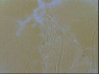Testechiniscus laterculus image