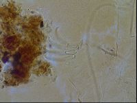 Testechiniscus laterculus image