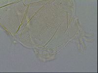 Testechiniscus laterculus image