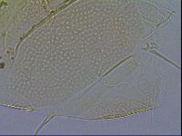 Testechiniscus laterculus image