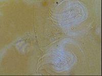 Testechiniscus laterculus image