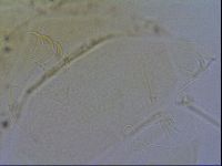 Testechiniscus laterculus image