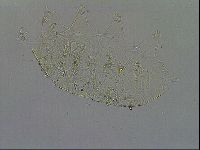 Testechiniscus laterculus image