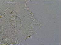 Testechiniscus laterculus image