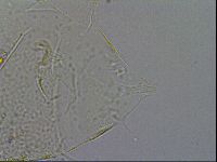 Testechiniscus laterculus image