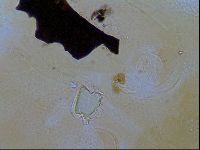 Testechiniscus laterculus image
