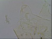 Testechiniscus laterculus image