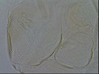 Testechiniscus laterculus image