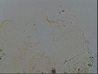 Testechiniscus laterculus image