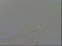 Testechiniscus laterculus image