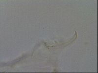 Testechiniscus laterculus image