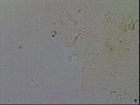 Testechiniscus laterculus image