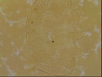 Testechiniscus laterculus image