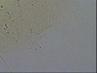 Testechiniscus laterculus image