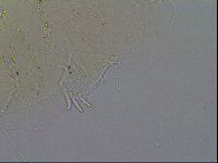 Testechiniscus laterculus image