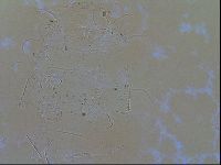 Testechiniscus laterculus image