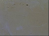 Testechiniscus laterculus image