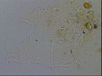 Testechiniscus laterculus image