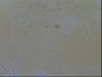 Testechiniscus laterculus image