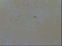 Testechiniscus laterculus image