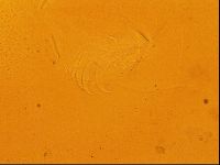Testechiniscus laterculus image