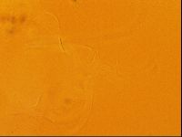 Testechiniscus laterculus image
