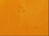 Testechiniscus laterculus image
