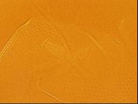 Testechiniscus laterculus image