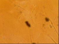 Testechiniscus laterculus image