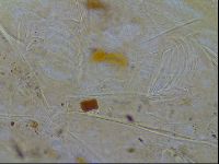 Testechiniscus laterculus image