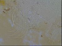 Testechiniscus laterculus image