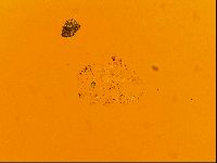 Testechiniscus laterculus image
