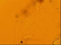 Testechiniscus laterculus image
